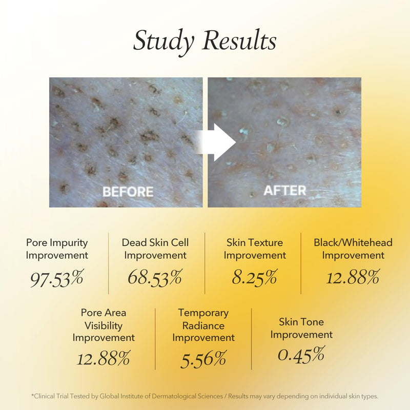 APRILSKIN Real Calendula Peel Off Pack