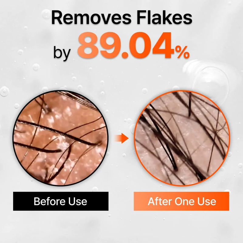 Lilyeve Grow Turn Exosome Brush Ampoule