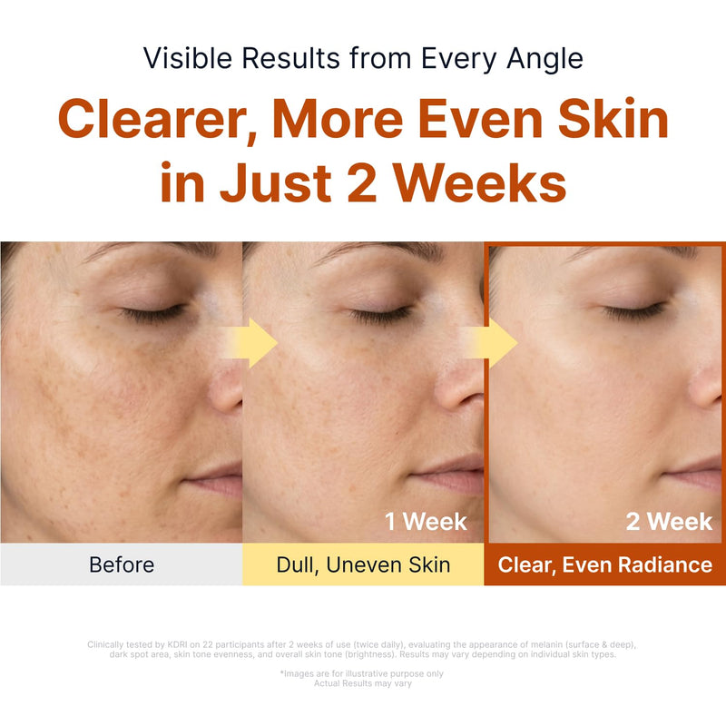 Sungboon Editor Kojic Acid Niacinamide Brightening Ampoule