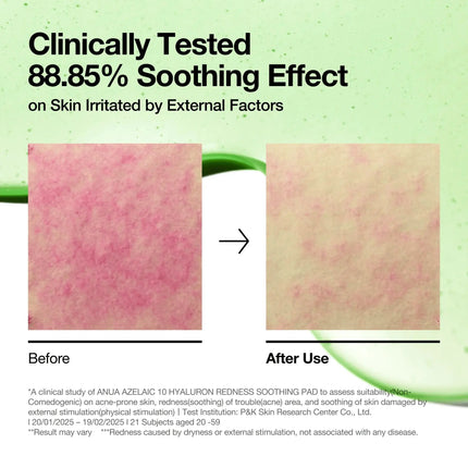 Anua Acid 10 Hyaluron Redness Soothing Pad