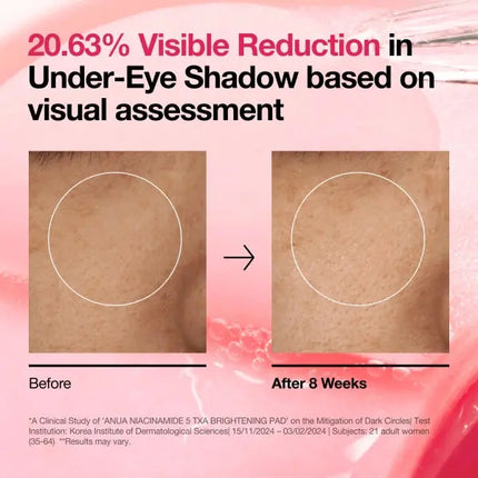 Anua Niacinamide 5 TXA Brightening Pad