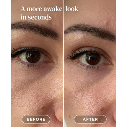 Apricot Beauty Eyelid Lifting Tapes