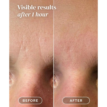 Apricot Beauty Facial Patches Niacinamide