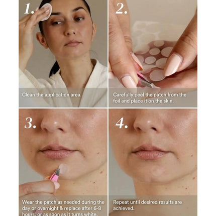 Apricot Beauty Post Pimple Patches