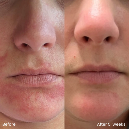 Clay And Glow Hydrating Moisturizer