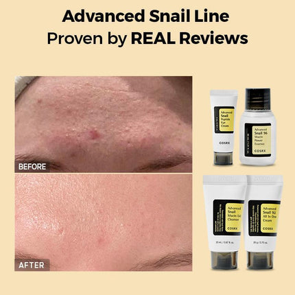 COSRX All About Advanced Snail Kit