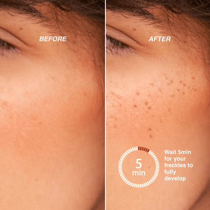 Freck Original Faux Freckles