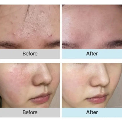 HYAAH Licorice First Essence