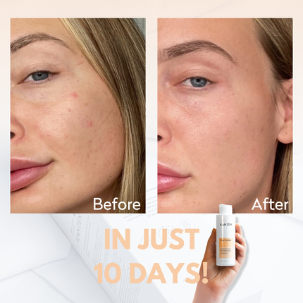 Kanzen Pore Purifier