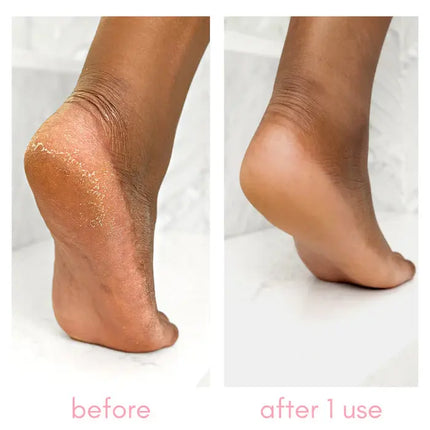 Kiara Sky Heel-ing Callus Remover