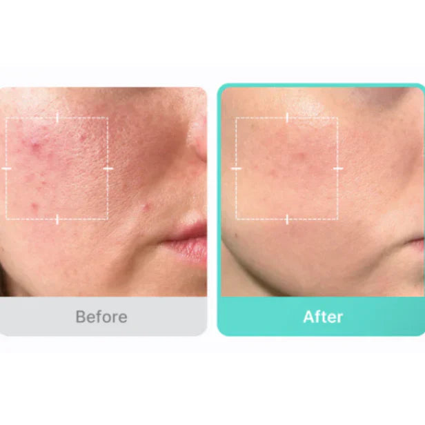Medicube Azelaic Acid 16 BB Soothing Serum
