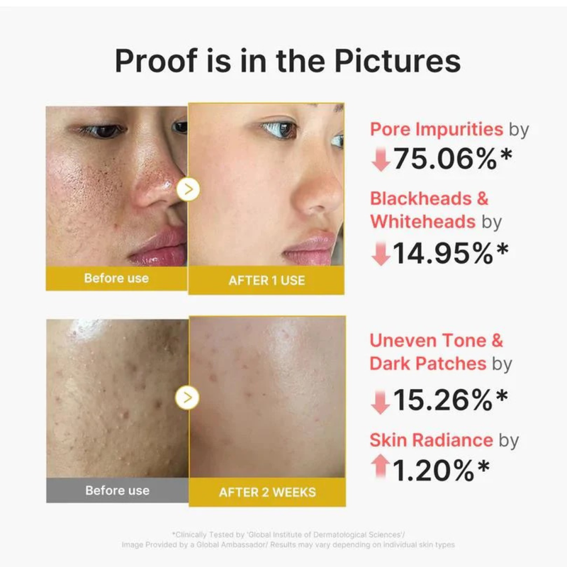 Medicube Kojic Acid Turmeric Peel Shot