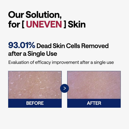 Mediheal Phyto Enzyme Exfoliating Pad