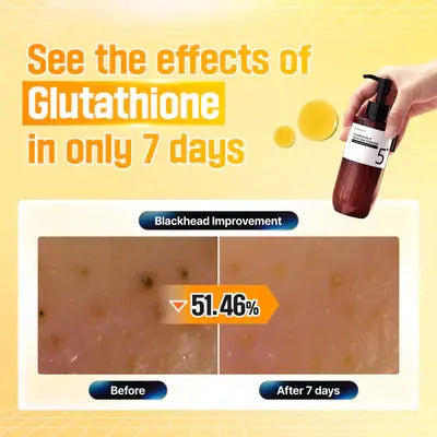 Buy Numbuzin No.5+ Glutathione Vitamin Facial Spa Cleanser online | Shop at Boozyshop! Buy Numbuzin No.5+ Glutathione Vitamin Facial Spa Cleanser online | Shop at Boozyshop!