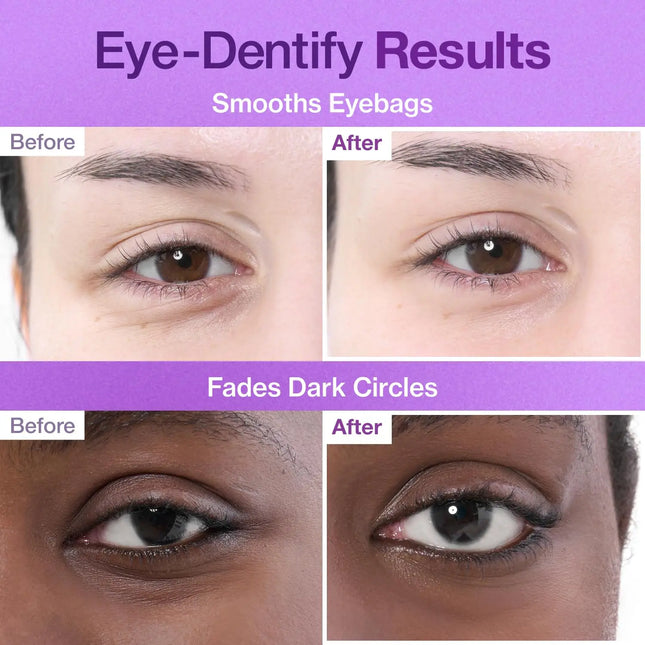 Numbuzin No.9 NAD+ Collagen Under Eye Patches