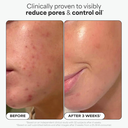 Paula's Choice BHA Liquid Exfoliant