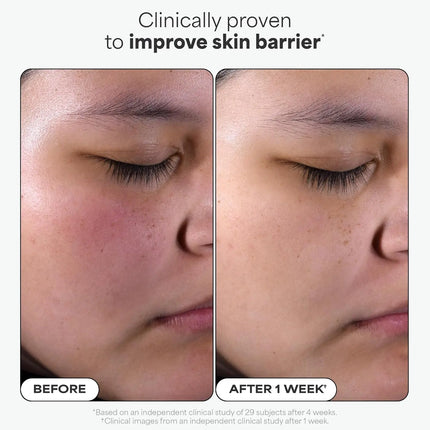 Paula's Choice BHA Liquid Exfoliant