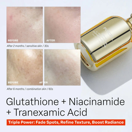 Purcell 88b/ml L-glutathione Flexible Liposome