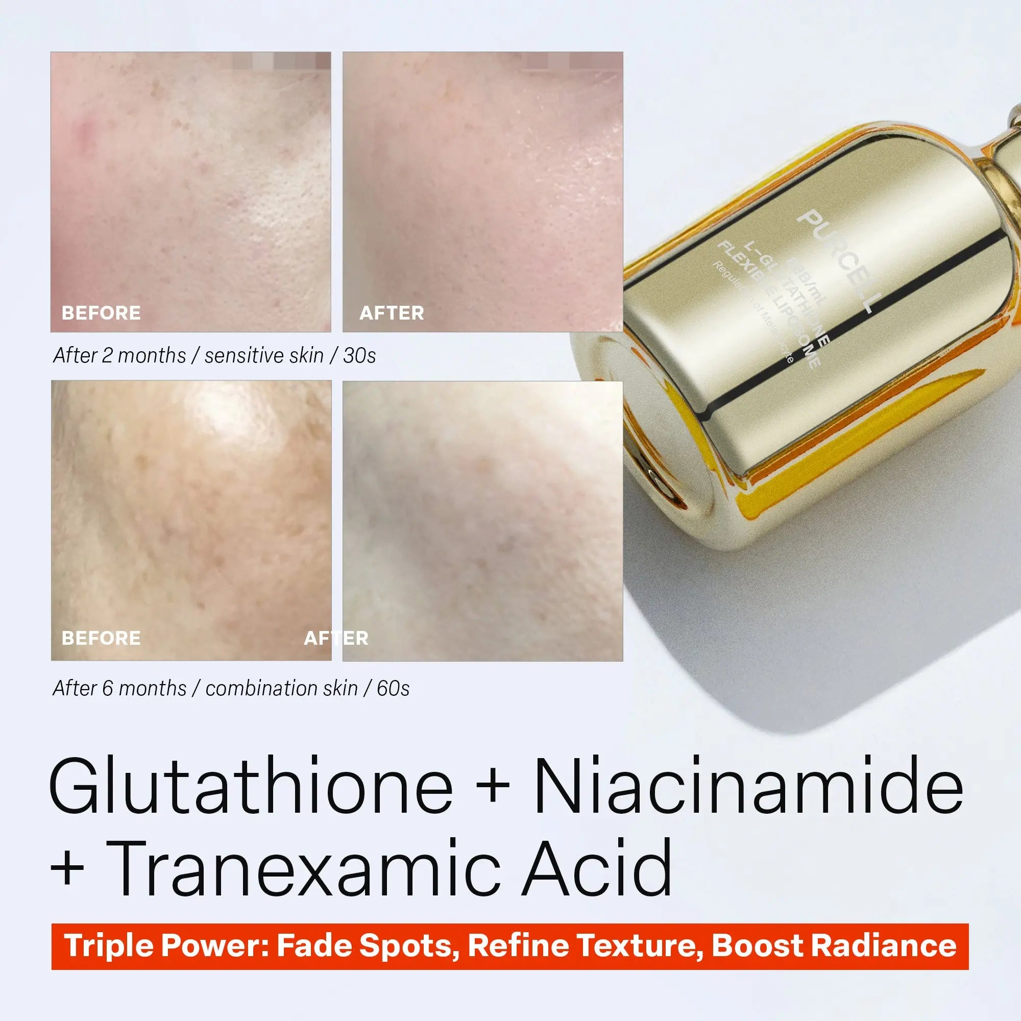 glutathione in turmeric Glutathione Turmeric glutathione in turmeric Glutathione Turmeric