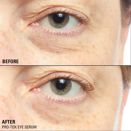 Revolution Pro-Tox Instant Fix Eye Firm