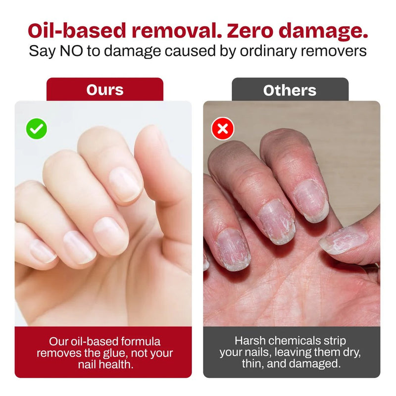 Secret Nails Click & Remove Pen Nail Glue Remover Oil Based, nagellijm remover pen, foto 3 van 9