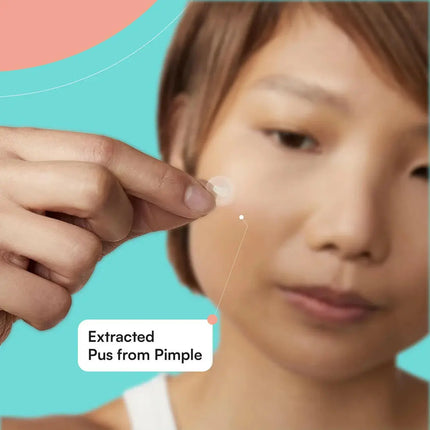 Skin Choice Breakout Patch Classic Pack Of 75