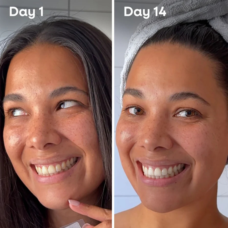 The Humble Co. Whitening Strips Fresh Mint