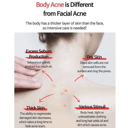 TIA’M Anti-blemish Body Lotion